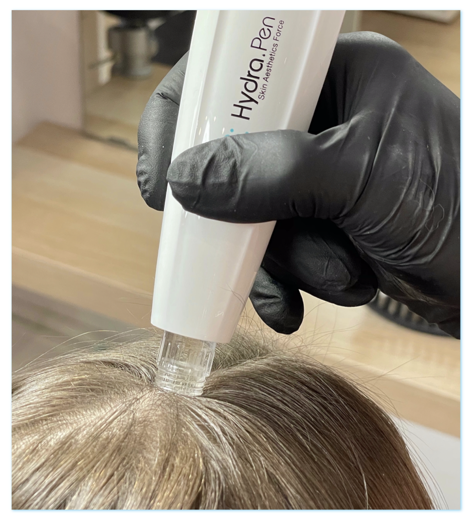 dermapen-foto